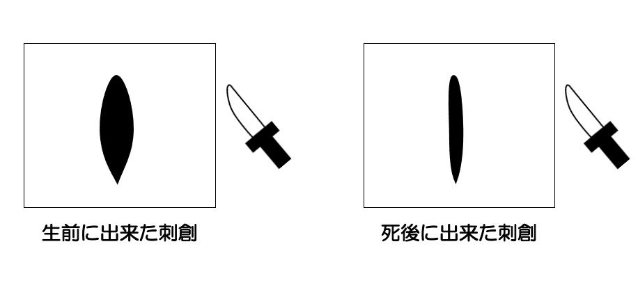 https://houigaku.blog/houigakublog/ante-post-stab.jpg