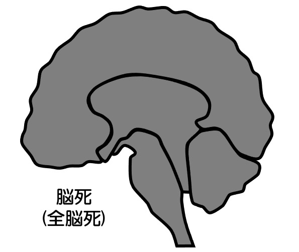 https://houigaku.blog/houigakublog/braindeath.jpg