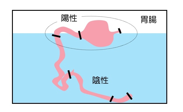 https://houigaku.blog/houigakublog/float2.jpg