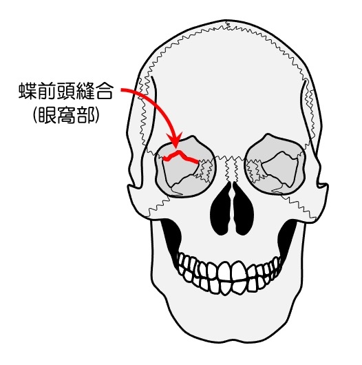 https://houigaku.blog/houigakublog/suture3.jpg