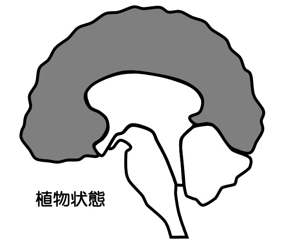 https://houigaku.blog/houigakublog/vegetative.jpg